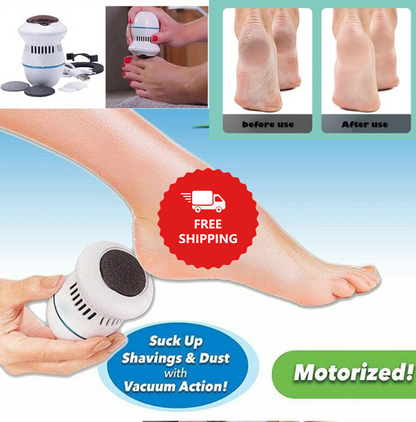 Electric Vacuum Foot Grinder File Machine Exfoliate Dead skin